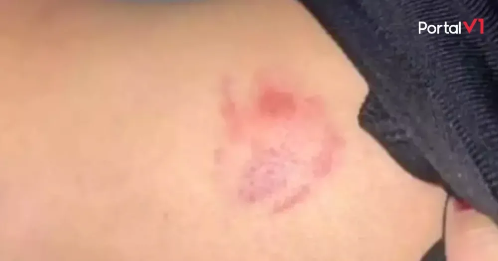 Mulher é agredida com mordida pelo companheiro e procura ajuda no Corpo de Bombeiros em Ivaiporã