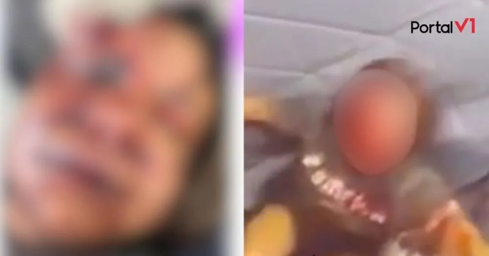 Mulher é brutalmente espancada por ex-jogador de basquete e terá que passar por cirurgia