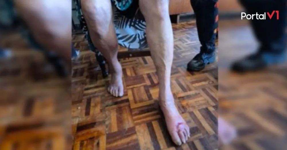 Idosa com Alzheimer é resgatada em meio a fezes e sangue enquanto filho escondia mais de R$ 100 mil em casa