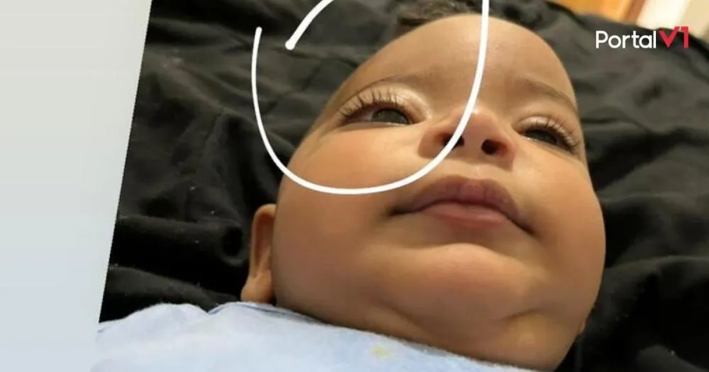 Família faz vaquinha para Matteo, bebê com plágiocefalia que precisa de órtese craniana urgente