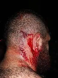 Morador é espancado após ser acusado de se envolver com ex-namorada de agressor