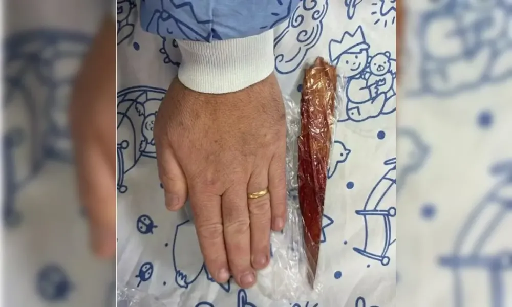 Farpa de 23 cm causa ferimento grave em criança após falha no palco do Teatro Guaíra