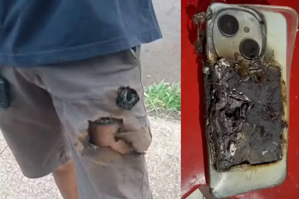 Mecânico é atacado por cães, celular explode no bolso e impede lesão mais grave no pescoço