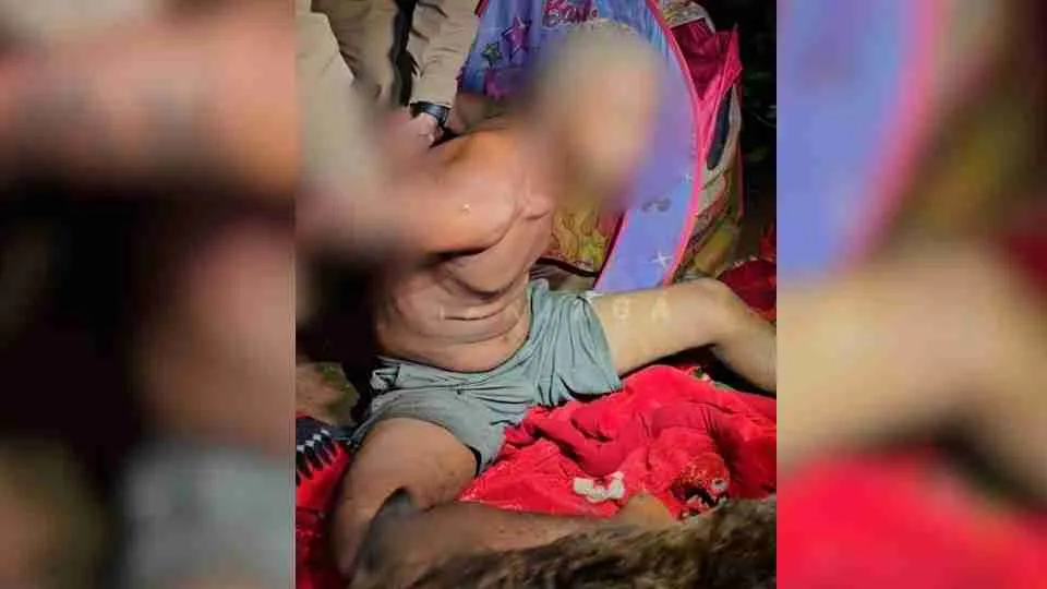 Mulher é internada em estado grave após ser incendiada; companheiro é preso por tentativa de feminicídio