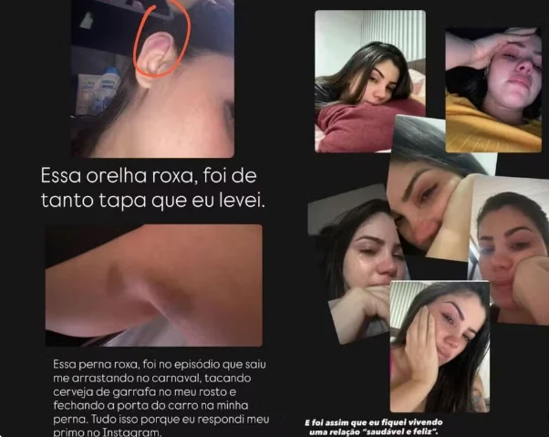 Ex-primeira-dama de Xapuri denuncia agressões físicas e psicológicas atribuídas ao prefeito após três anos de relacionamento