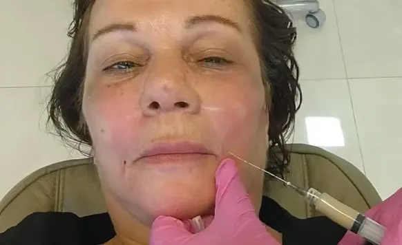 Estudante sem registro é denunciado após morte de paciente em procedimento estético