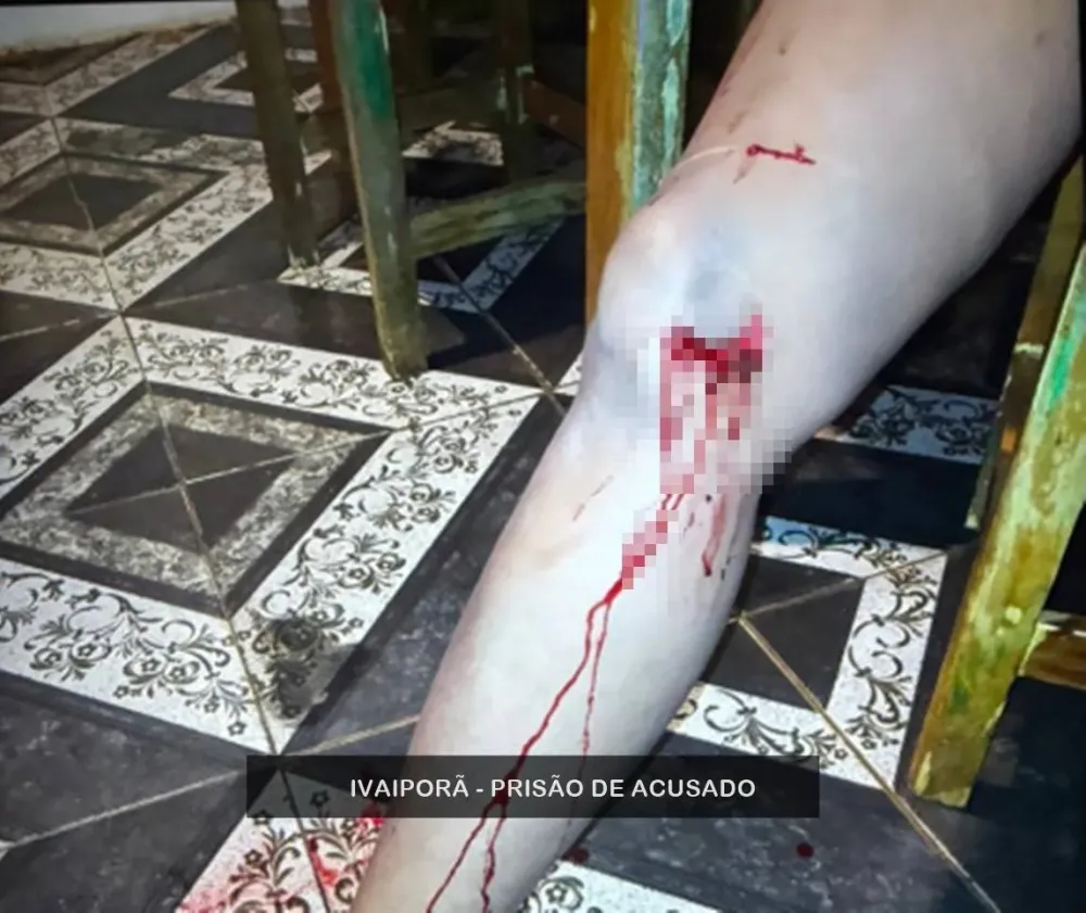 Suspeito de tentar matar mulher com facão é preso pela Polícia Civil em Ivaiporã
